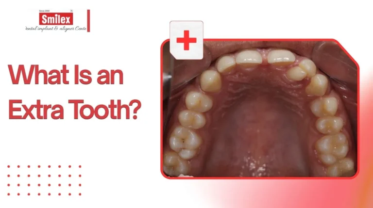 Extra Tooth