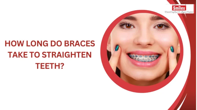 braces treatment time
