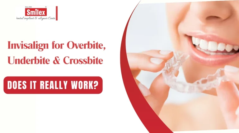 Invisalign for Overbite, Underbite & Crossbite