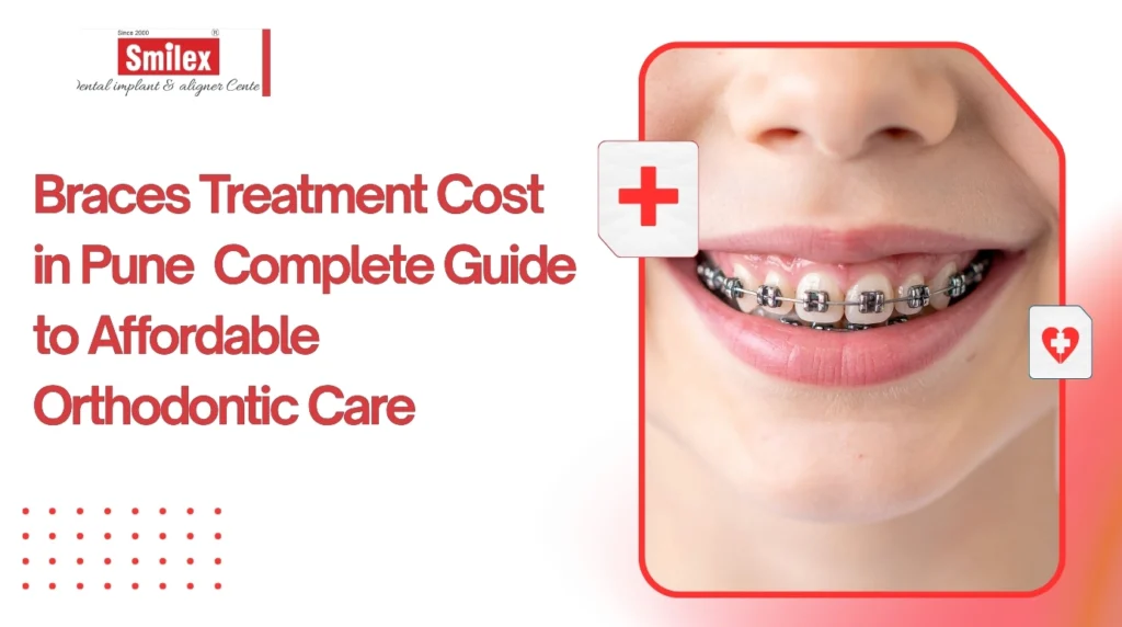Braces Treatment Cost in Pune