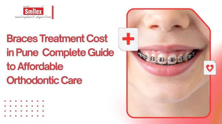 Braces Treatment Cost in Pune