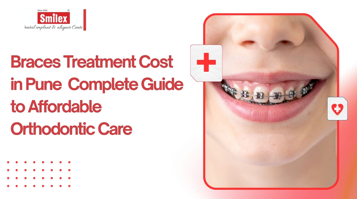 Braces Treatment Cost in Pune