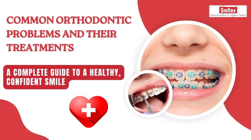 Common Orthodontic Problems