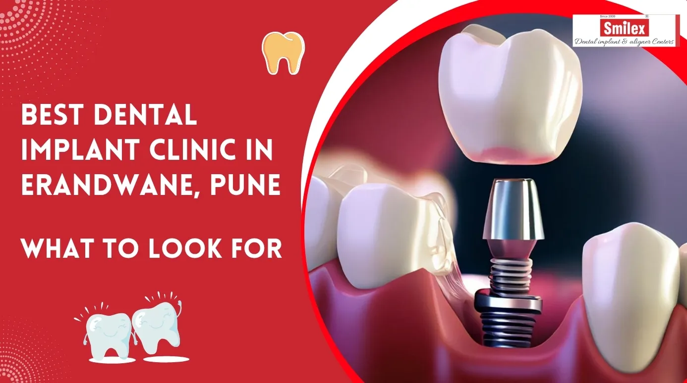 Best Dental Implant Clinic in Erandwane, Pune | What to Look For