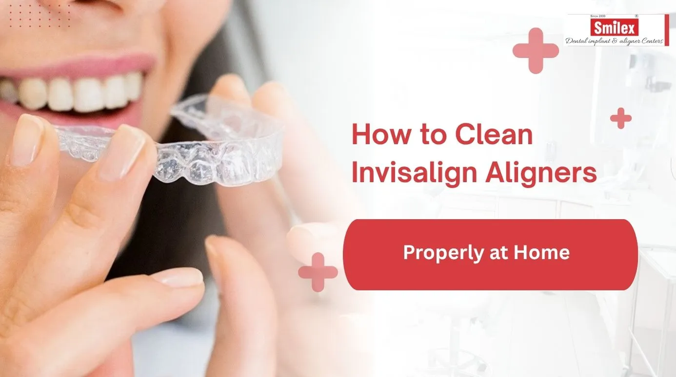 How to Clean Invisalign Aligners Properly at Home
