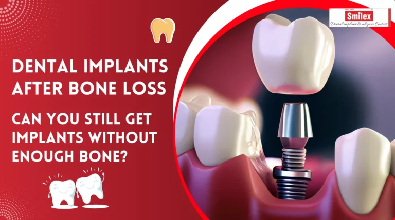 Dental Implants After Bone Loss