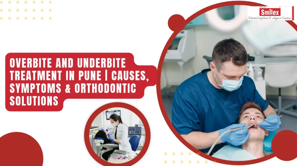 Overbite and Underbite Treatment in Pune